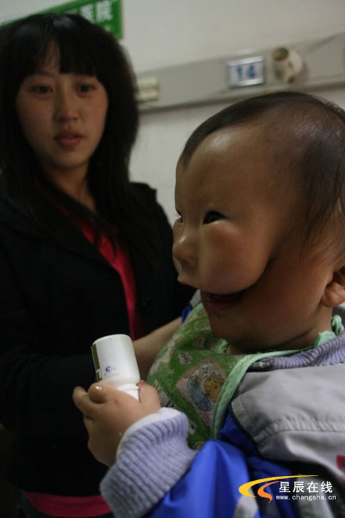 Kang Kang Le Bebe Chinois Ne Avec Deux Visages Le Saviez Vous
