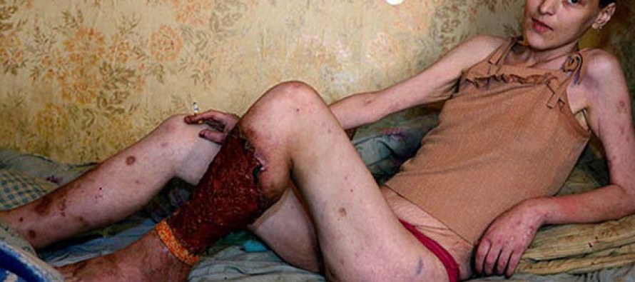 Krokodil, la nouvelle drogue aux effets dévastateurs