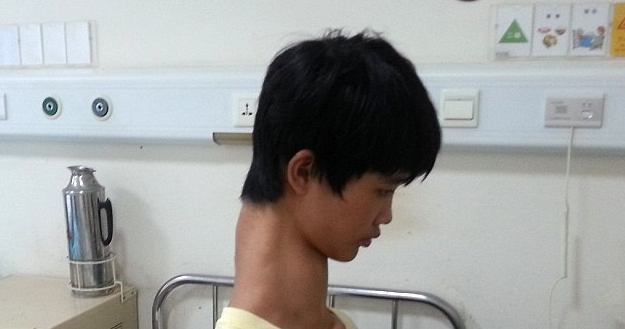 Insolite: Ce chinois possède le plus long « cou » du monde (photos)